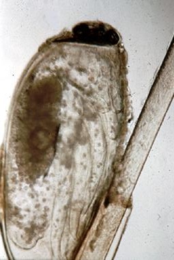 Гнида под микроскопом фото